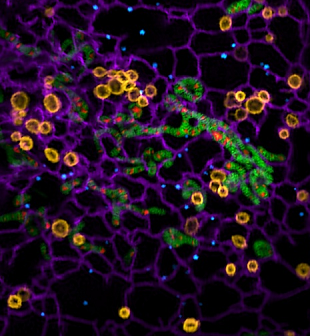 New Technique Reveals Novel Phenomena of Organelle Interaction