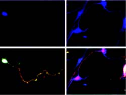 Studies gain insight into neuronal polarity