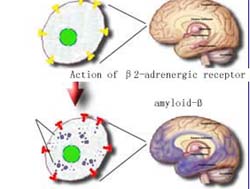 CAS researchers find a new mechanism for the pathogenesis of Alzheimer's disease