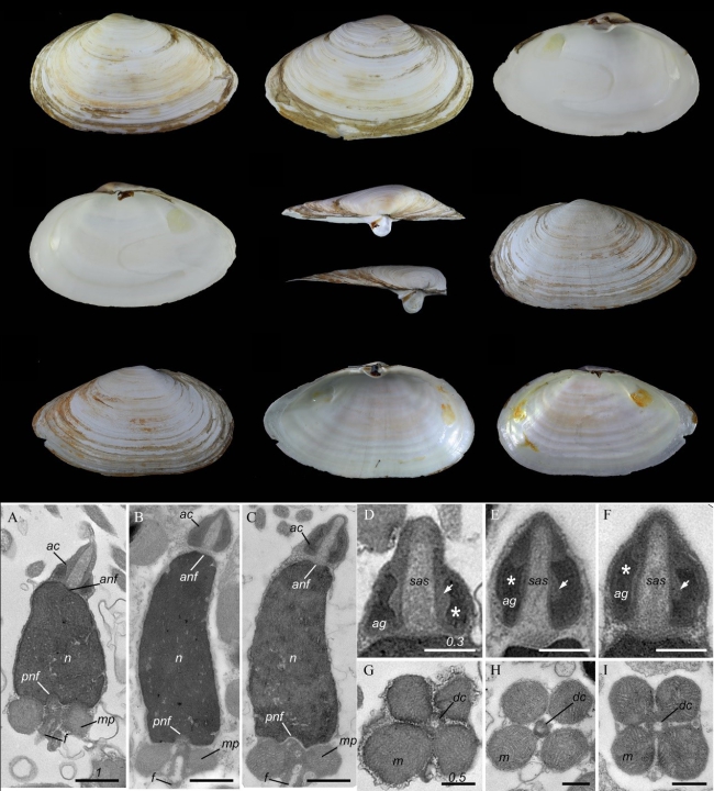 Shell morphology and spermatozoan ultramorphology of M. arenaria and M. japonica..jpg