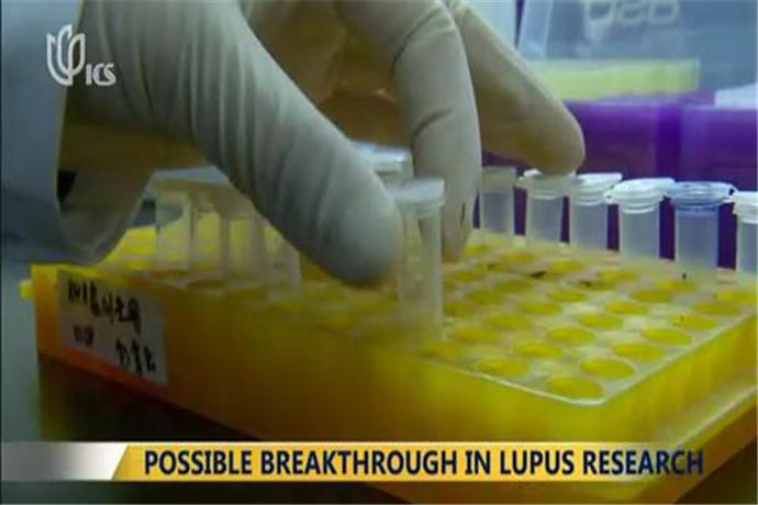 Possible Breakthrough in Lupus Research