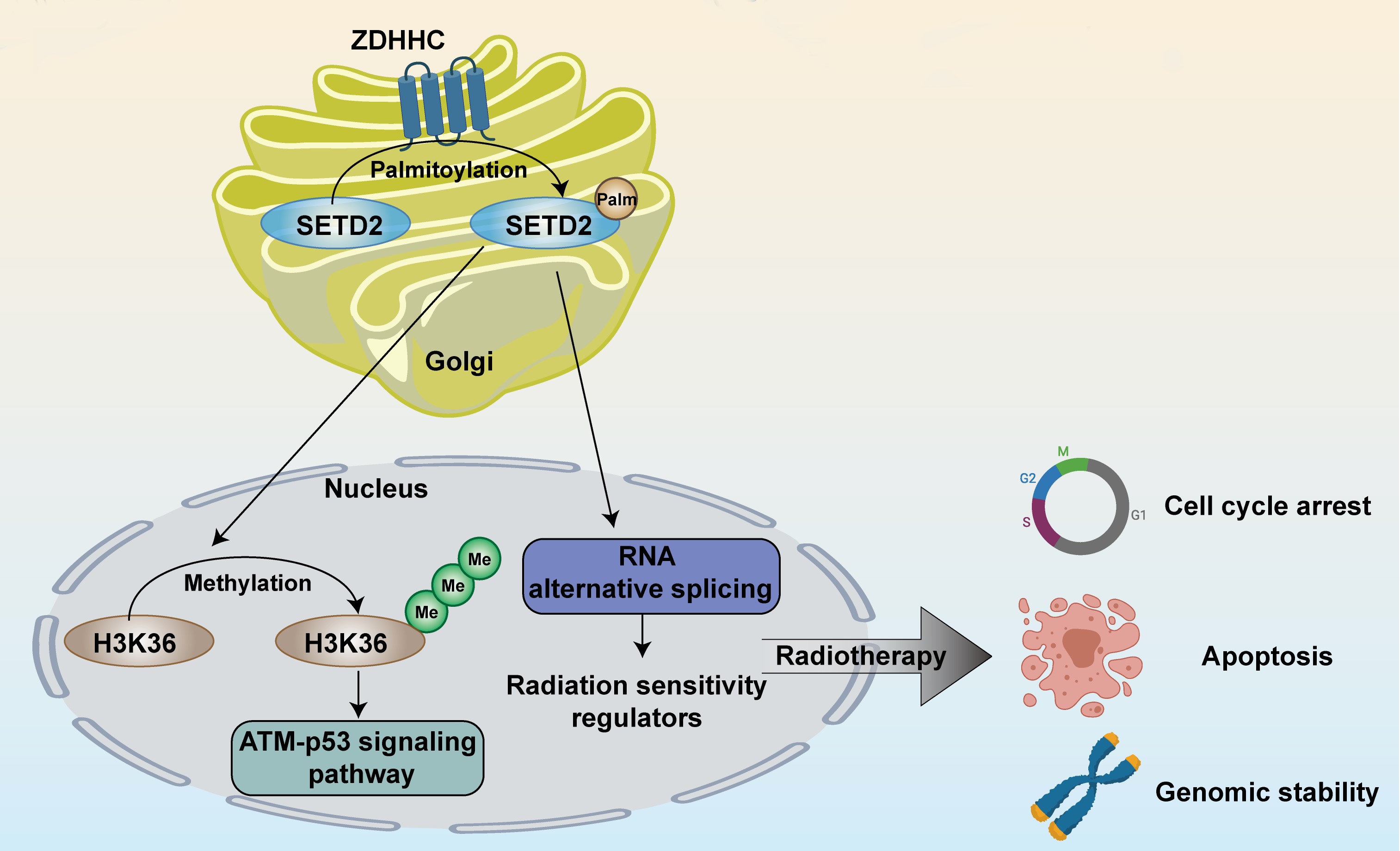 Study Identifies Promotional Role of SEDT2 Palmitoylation in Glioblastoma