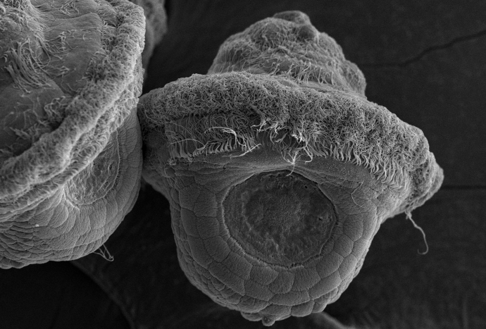 Larval Shell Formation in Patellogastropod Mollusk Requires Nonmuscle Myosin II: Study