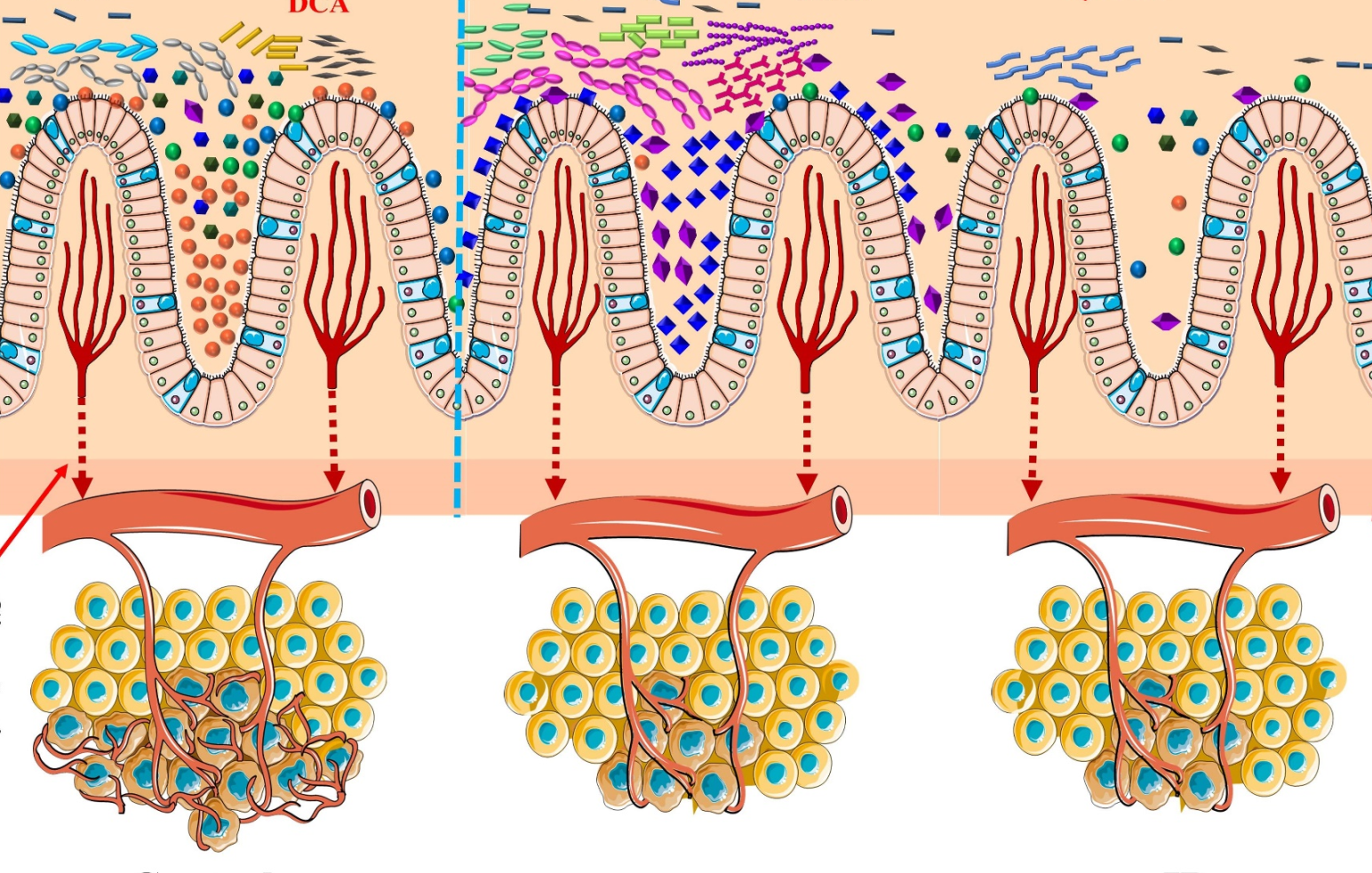Study Provides New Insights for Prevention and Treatment of Colon Cancer by Probiotics Intervention
