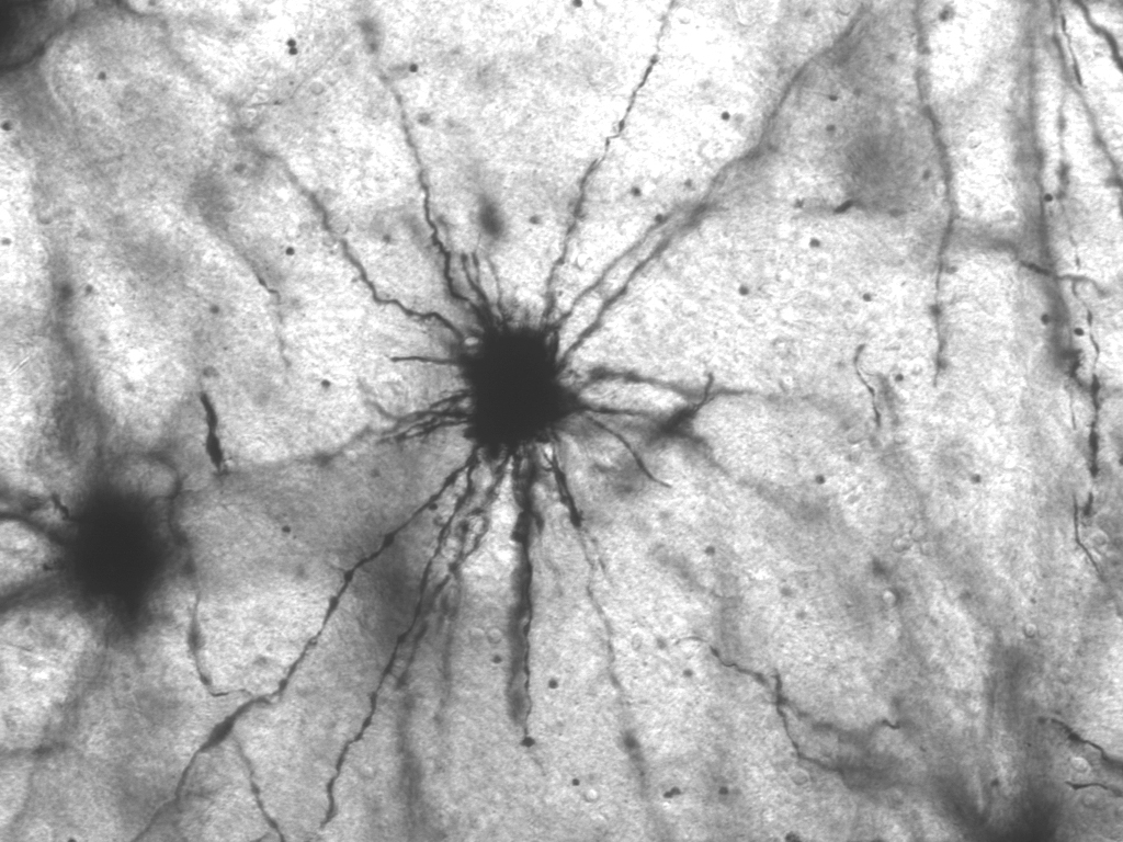 Chinese Scientists Uncover Metformin’s Potential to Delay Aging in Primates
