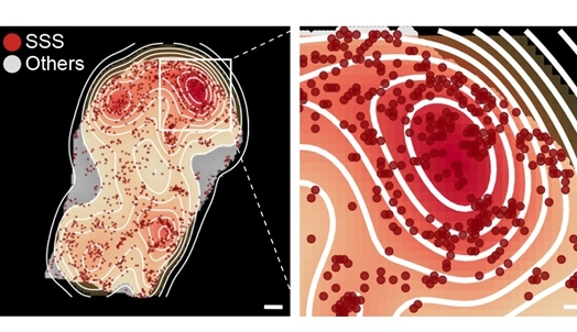 Unveiling the Secrets of Aging: Chinese Scientists Discover Dual Role of Immunoglobulins