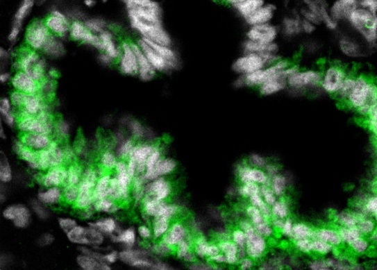 DHA-PA-PG Aixs Regulates Transition from Endogenous to Exogenous Nutrition in Fish Larvae