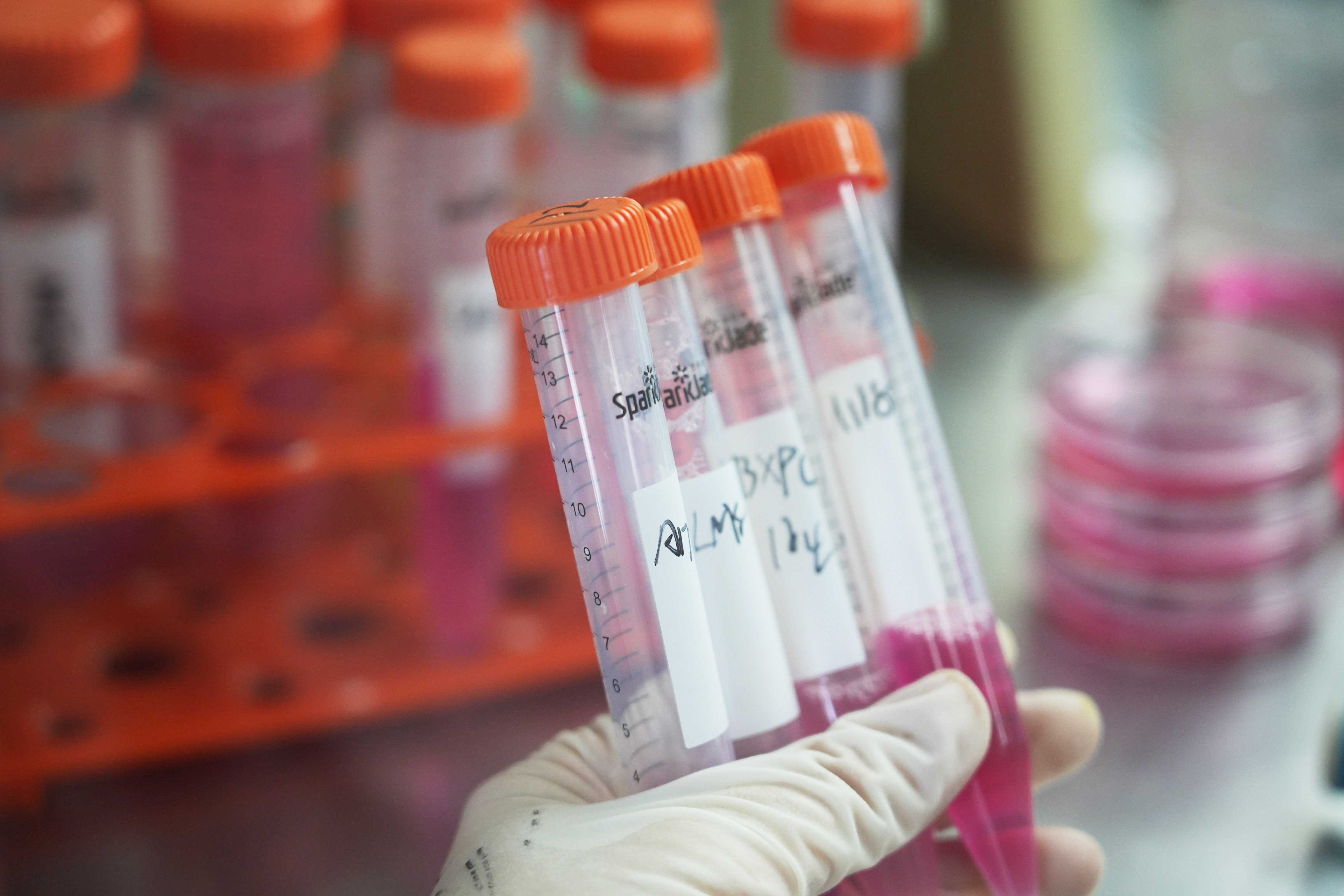 New Natural Molecule Boosts CAR-T Therapy and Turns Cold Tumors Hot