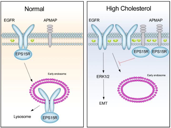 Model for cholesterol-induced epithelial to mesenchymal transition.jpg