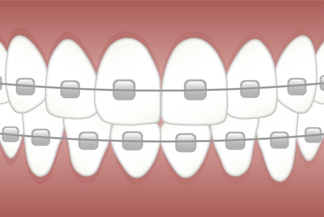 An Approach to Simulating Orthodontic Force of Archwire Applied to Full Dentition