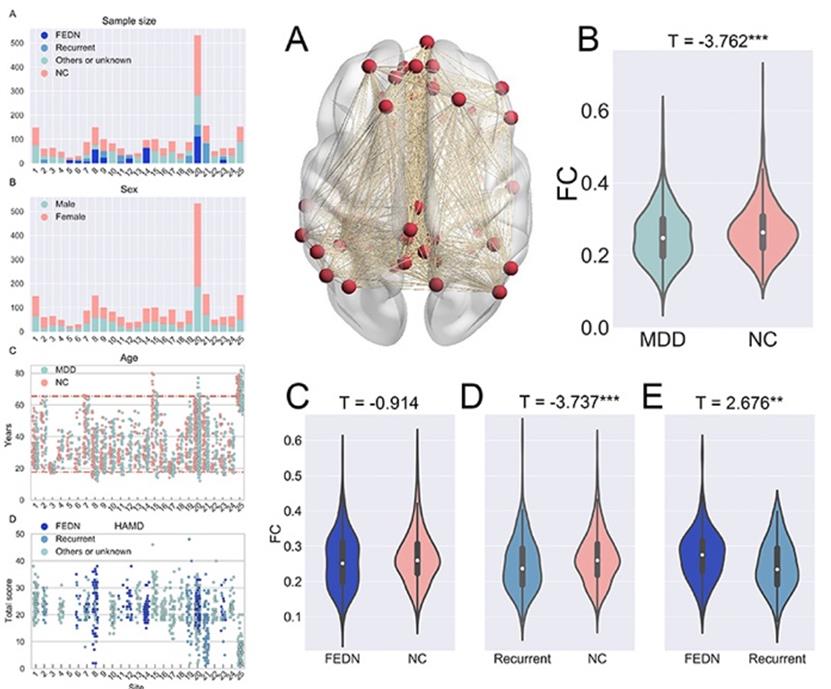 The world's largest MDD R-fMRI dataset revealed a reduced DMN FC pattern in recurrent MDD patients
