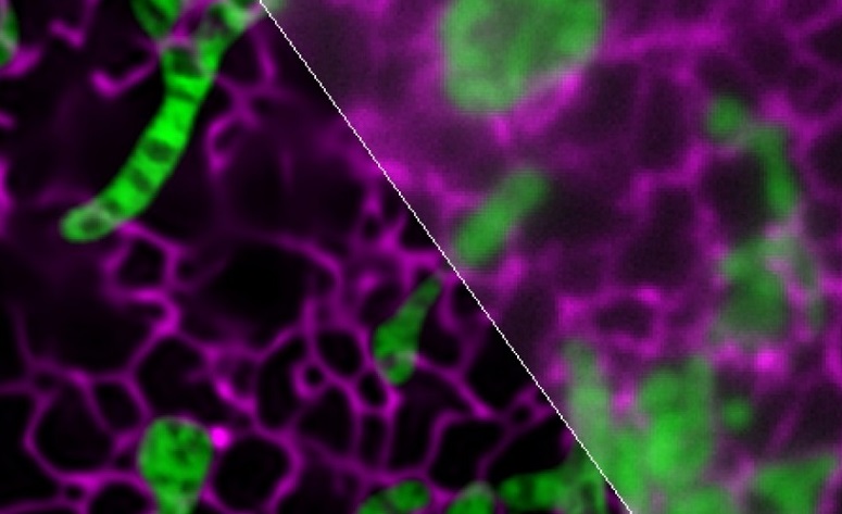 Scientists Develop Novel Deep Neural Networks for Image Super-resolution in Optical Microscopy