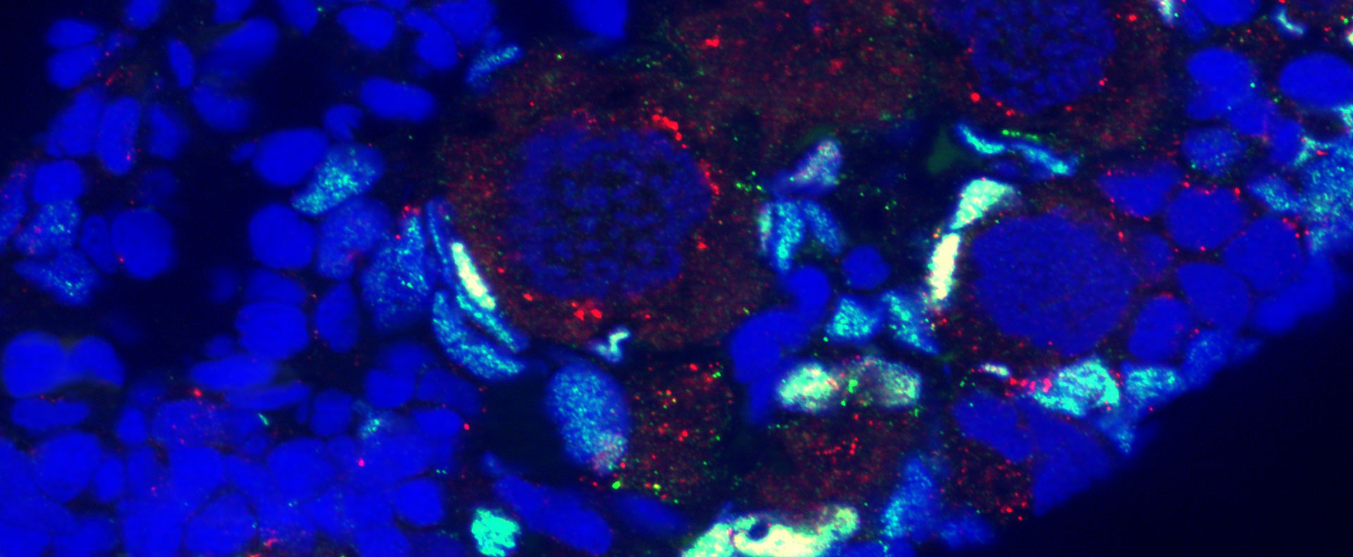 Researcher Reveal Functional Divergence of Multiple Duplicated Foxl2 Homeologs and Alleles in Recurrent Polyploid Fish