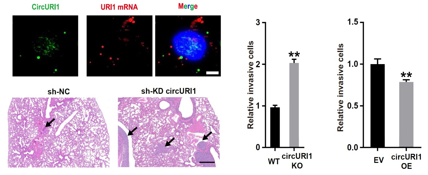 CircURI1 suppresses cell invasion and gastric cancer metastasis