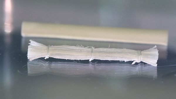 NeuroRegen Scaffold Transplantation Brings Hope to Spinal Cord Injury Patients