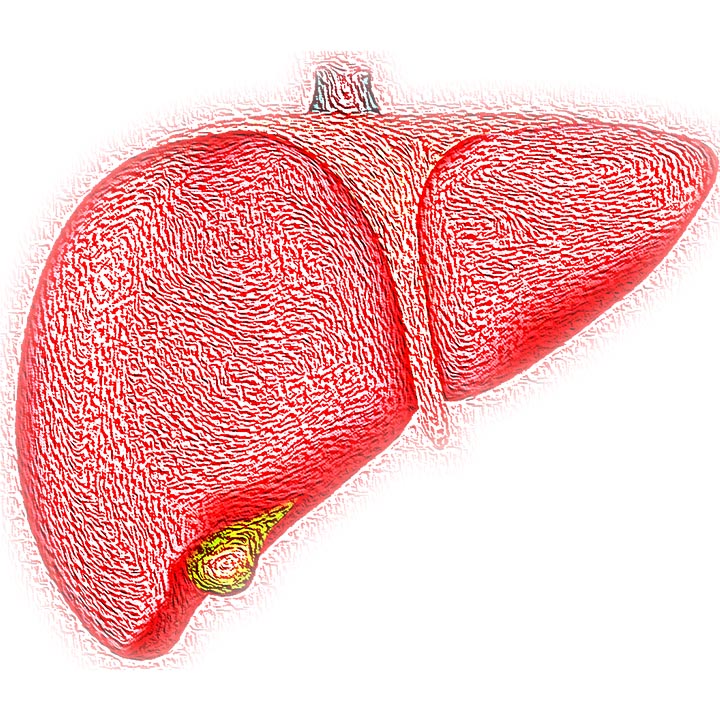 New Study Sheds Light on How Fatty Liver Disease Turns into Liver Cancer