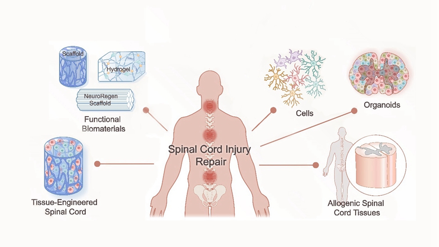 Biomaterial-Based Spinal Cord Injury Repair