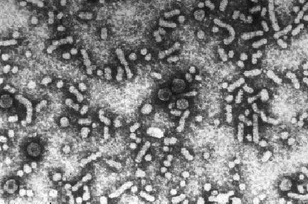 Chinese Scientists Discover New Anti-HBV Gene