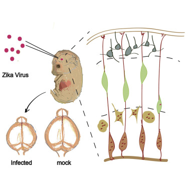 Zika virus disrupts neural progenitor development and leads to microcephaly in mice