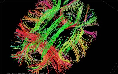 human brain.jpg