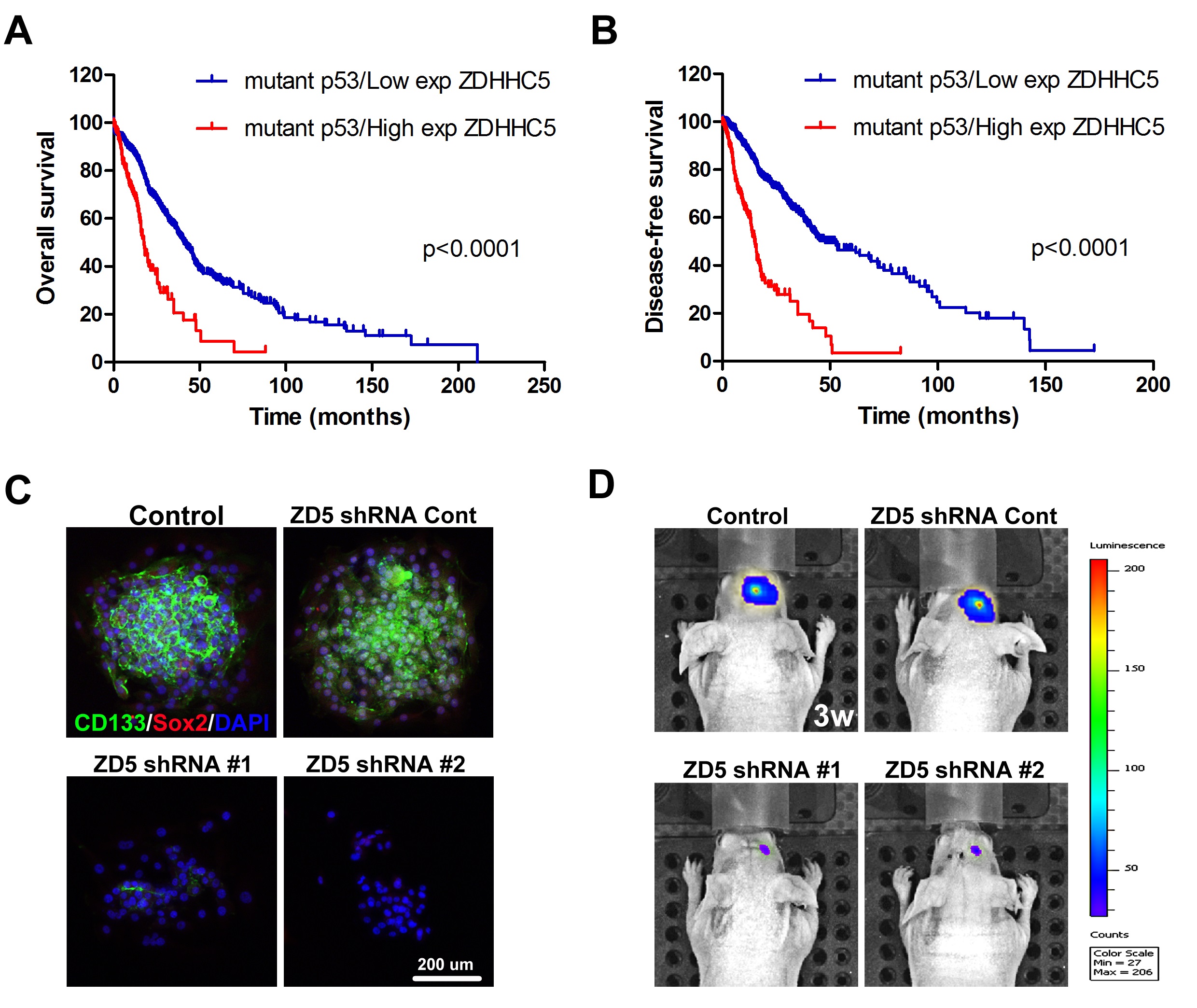 The role of ZDHHC5 in the development and progression of p53-mutant glioma