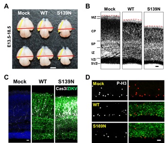 ZIKV S139N mutant causes more significant microcephaly