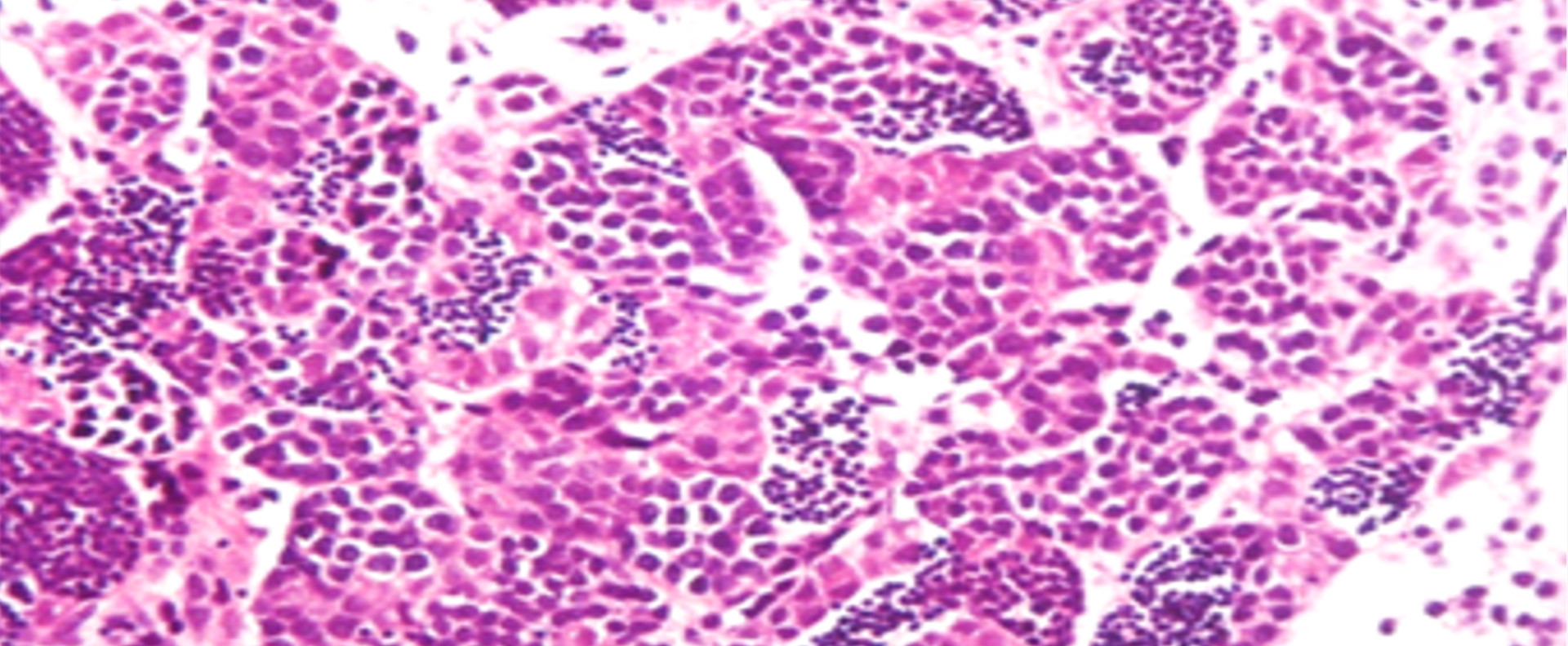 Researchers Uncover Novel Role of Progestin Signaling in Fish Spermatogenesis