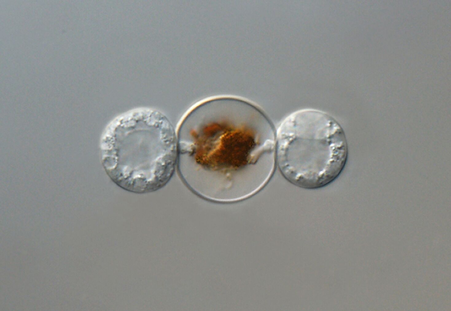 Oxidative Stress Facilitates Infection of Unicellular Alga <em>Haematococcus pluvialis</em> by Fungus <em>Paraphysoderma sedebokerense</em>