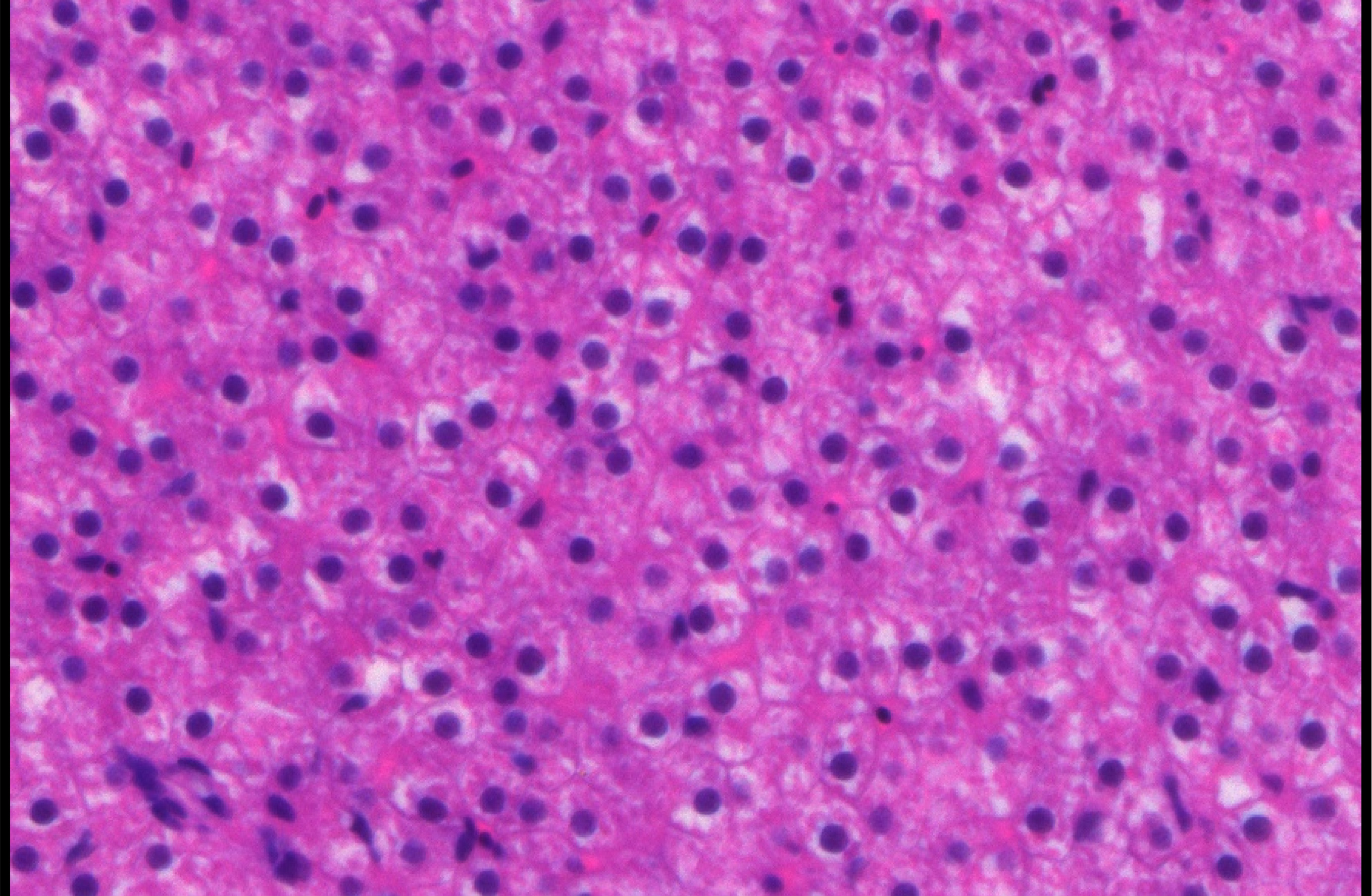 Role of OTUD3 in Innate Immunity Differs Between RNA and DNA Viral Infections