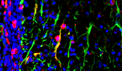 Researchers Unravel Key Role of Astrocytic Dopamine Receptor D2 in Autoimmune Diseases of Central Nervous System