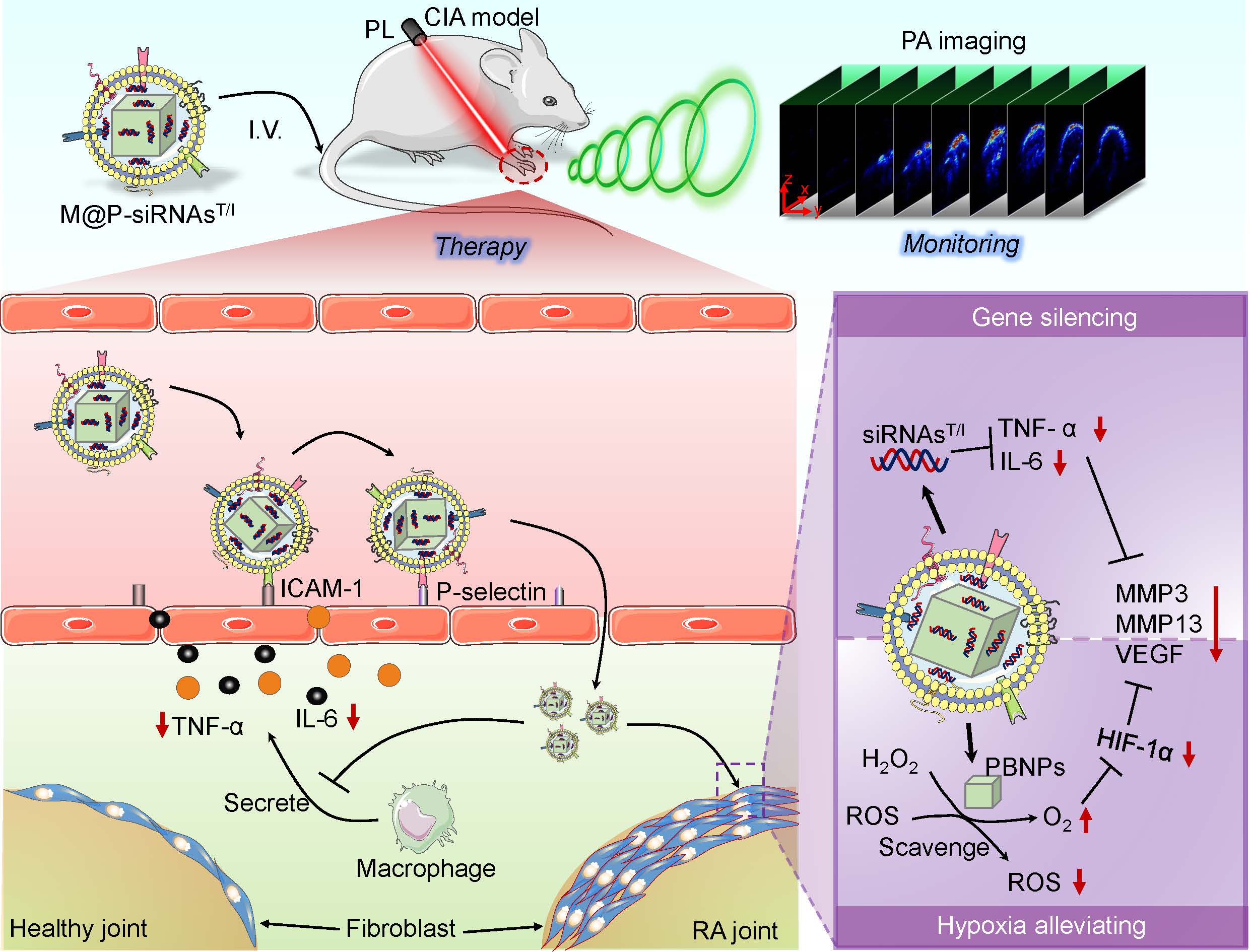 New Strategy Enables Targeted Treatment of Rheumatoid Arthritis