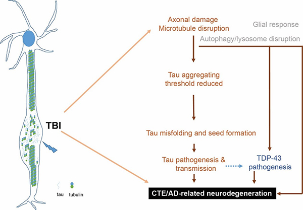 Researchers Show How Repeated Traumatic Brain Injury Contributes to Alzheimer's Disease