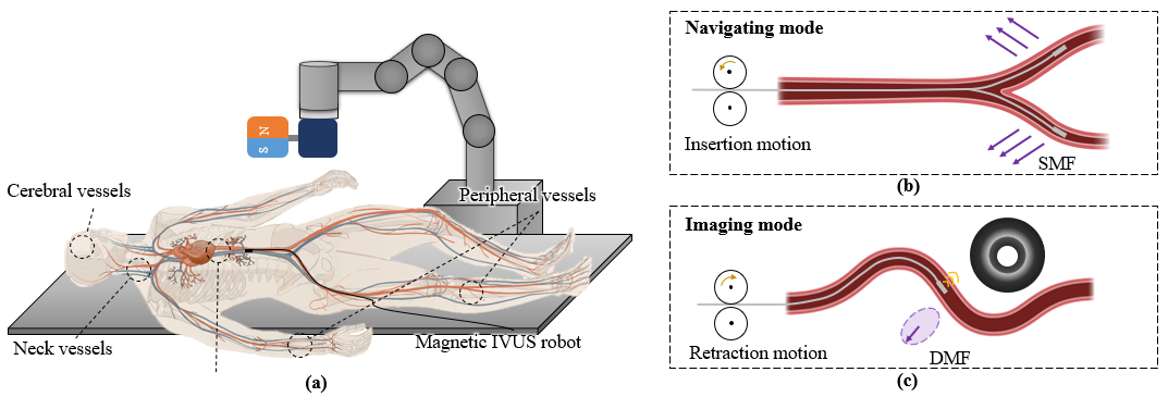 Scientists Propose Magnetic Intravascular Ultrasound Robot