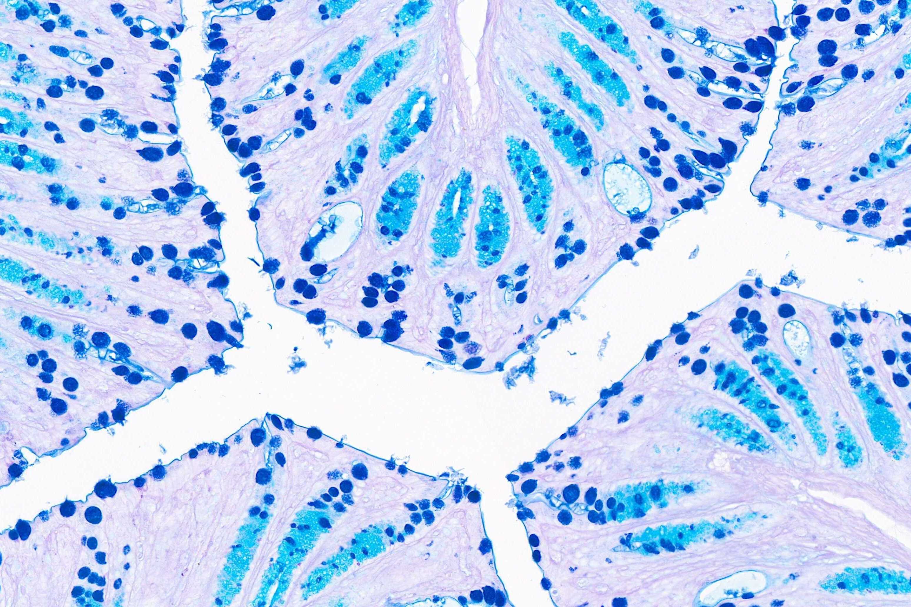 TBPH Promotes Inflammatory Bowel Disease Development via Gut Microbiota-Arachidonate Metabolic Axis