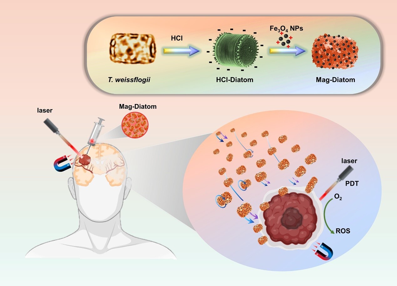 珪藻ベースのマイクロロボットが膠芽腫の標的光線力学療法に有望 (Diatom-Based Microrobots Show Promise for Targeted Photodynamic Therapy of Glioblastoma)