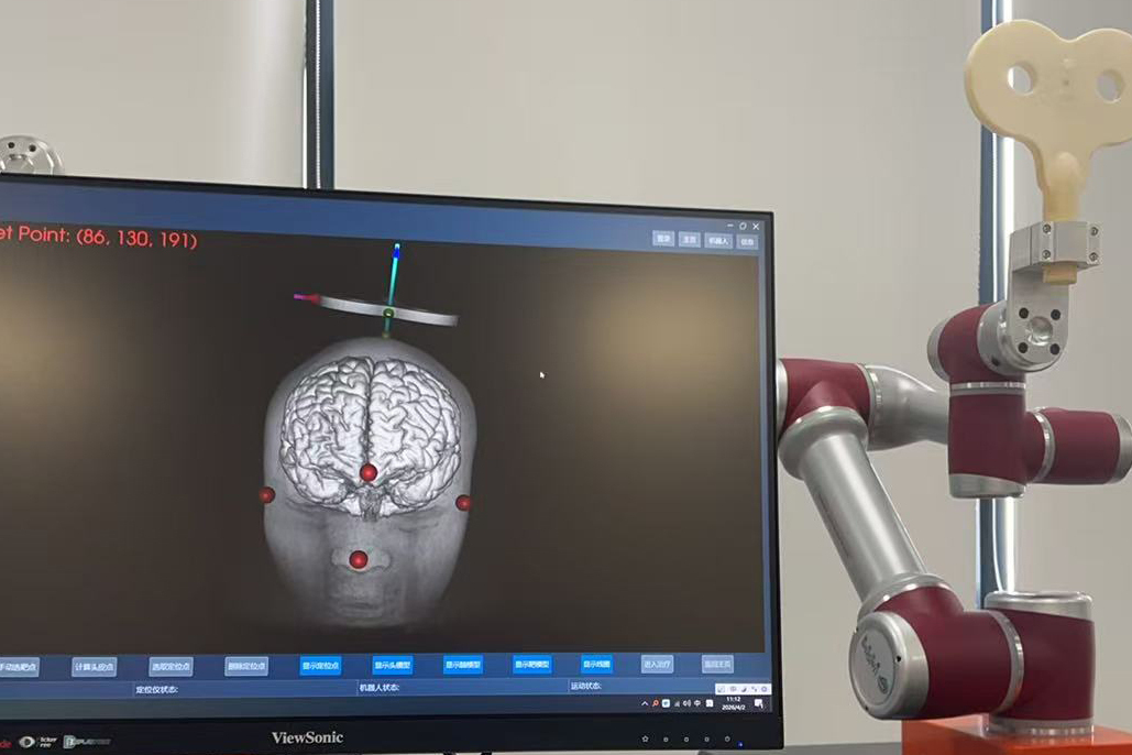 Researchers Develop Intelligent Robot for Precision Brain Stimulation Therapy