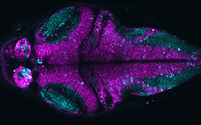 Researchers Reveal Whole-brain Computational Mechanisms Underlying Sequential Decisions in Zebrafish