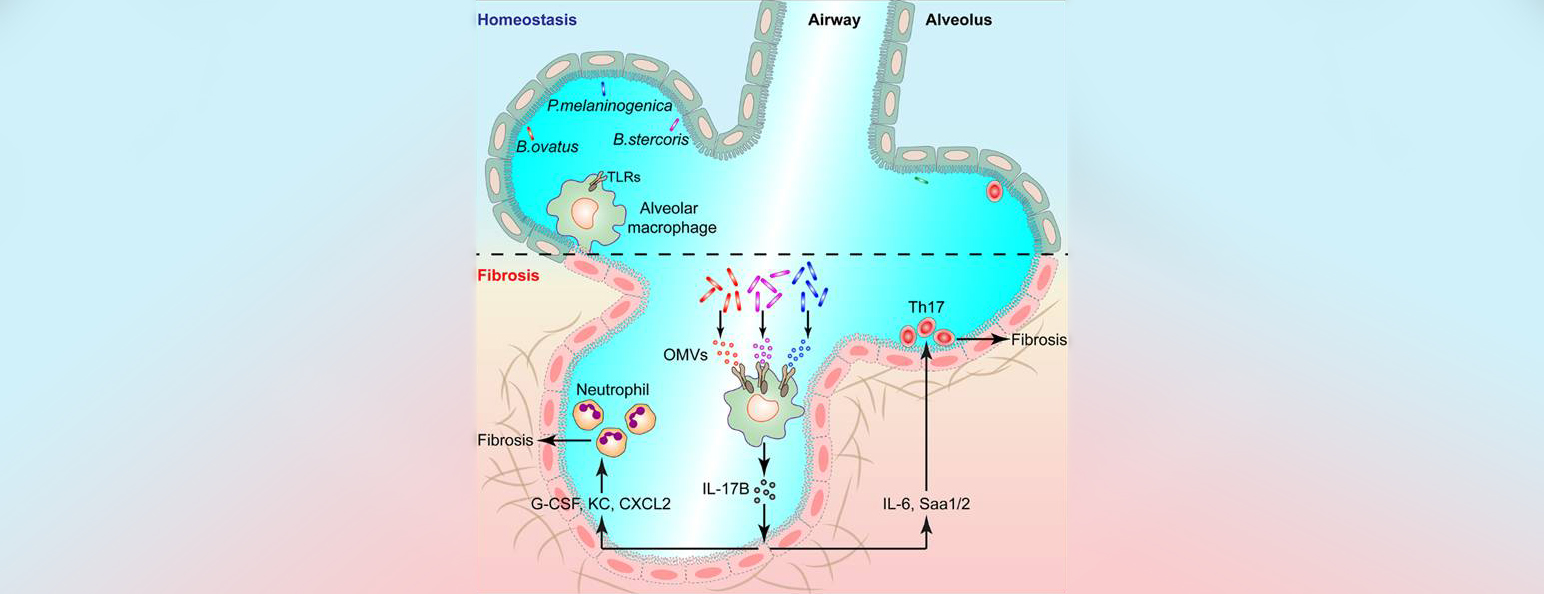 The model of lung microbiota to promote fibrosis.jpg