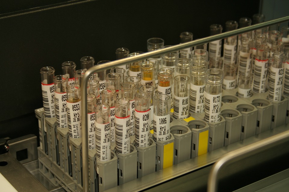 urine sample.jpg
