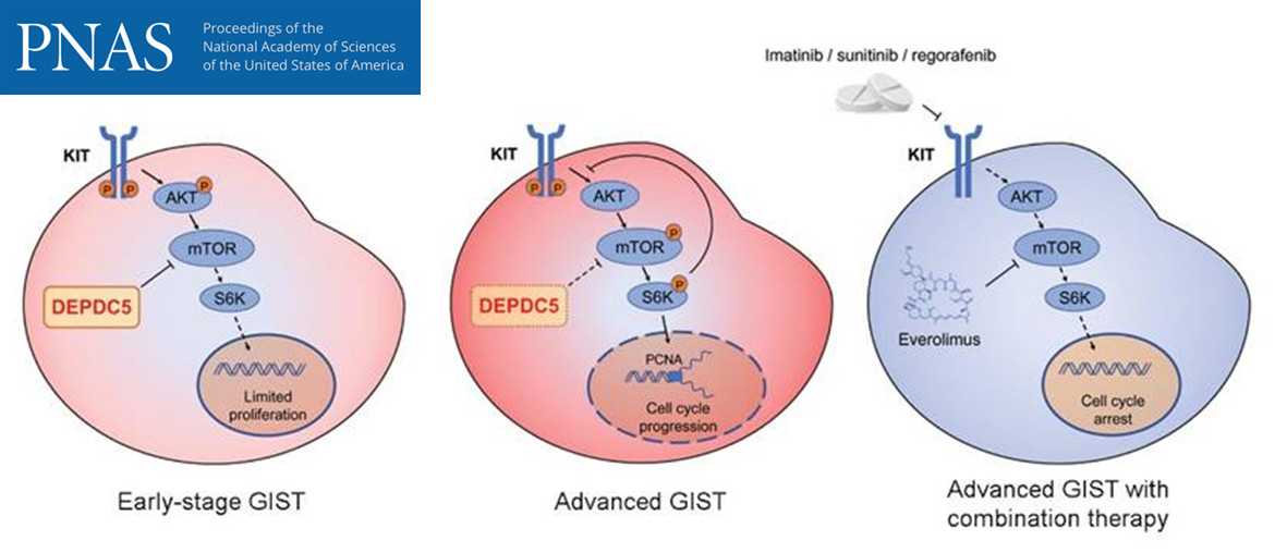DEPDC5 inactivated mutations promote gastrointestinal stromal tumor (GIST) progression.jpg
