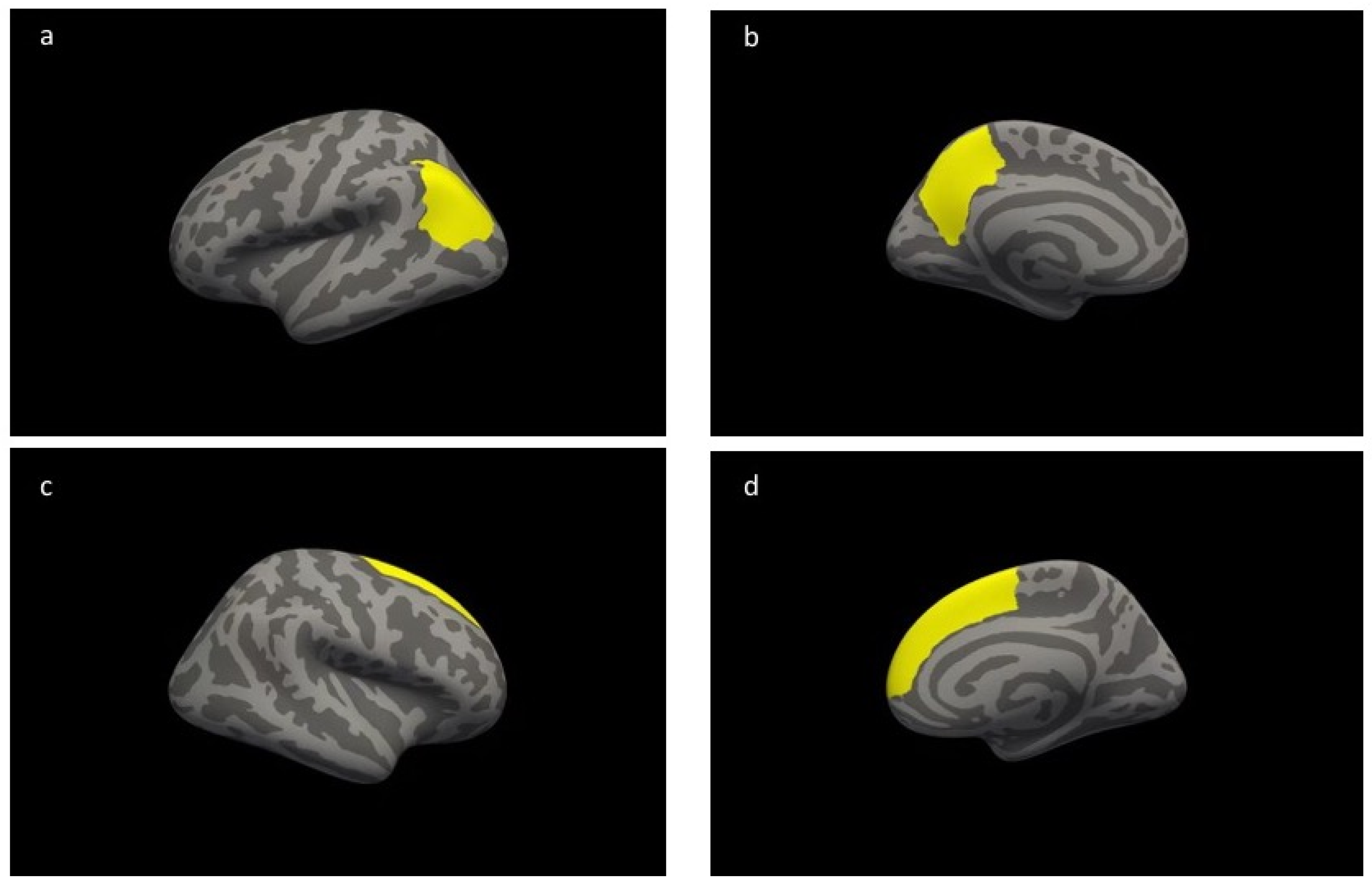 Sports Training Helps Better Understand Neural Mechanisms of Volitional Behaviors in Human Brain