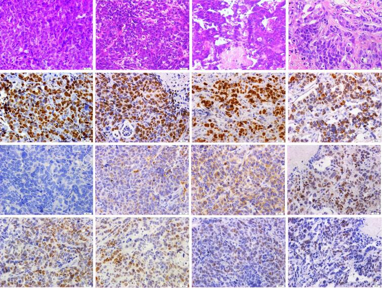 The combined use of CUDC-907 and olaparib effectively suppresses tumor growth in a PDX model of SCLC