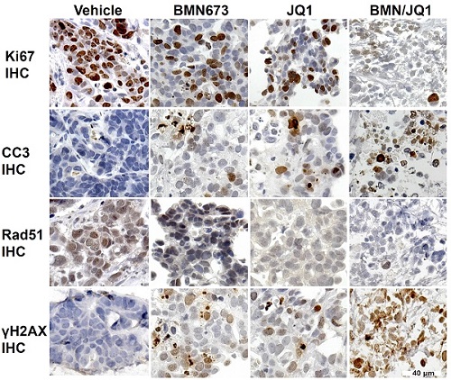 Dual inhibition of MYC and PARP led to synthetic lethality effects in SCLC.jpg