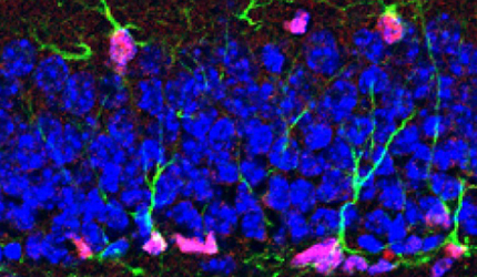 430Nuclear isoform of FGF13 regulates postnatal neurogenesis in hippocampus through epigenomic mechanism.jpg