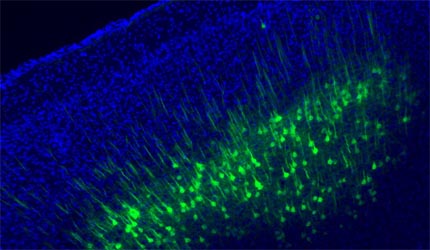 Researchers Unravel Cortico-collicular Circuit Mechanism Underlying Motor Planning During Decision-making