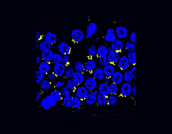 Tick Tock in Brain: Scientists Provide Molecular Insights into Primate Hippocampal Aging
