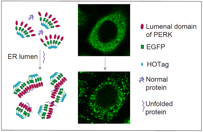 Researchers have developed a fluorescent reporting system to observe the accumulation of unfolded proteins within the endoplasmic reticulum (ER) of live cells..png