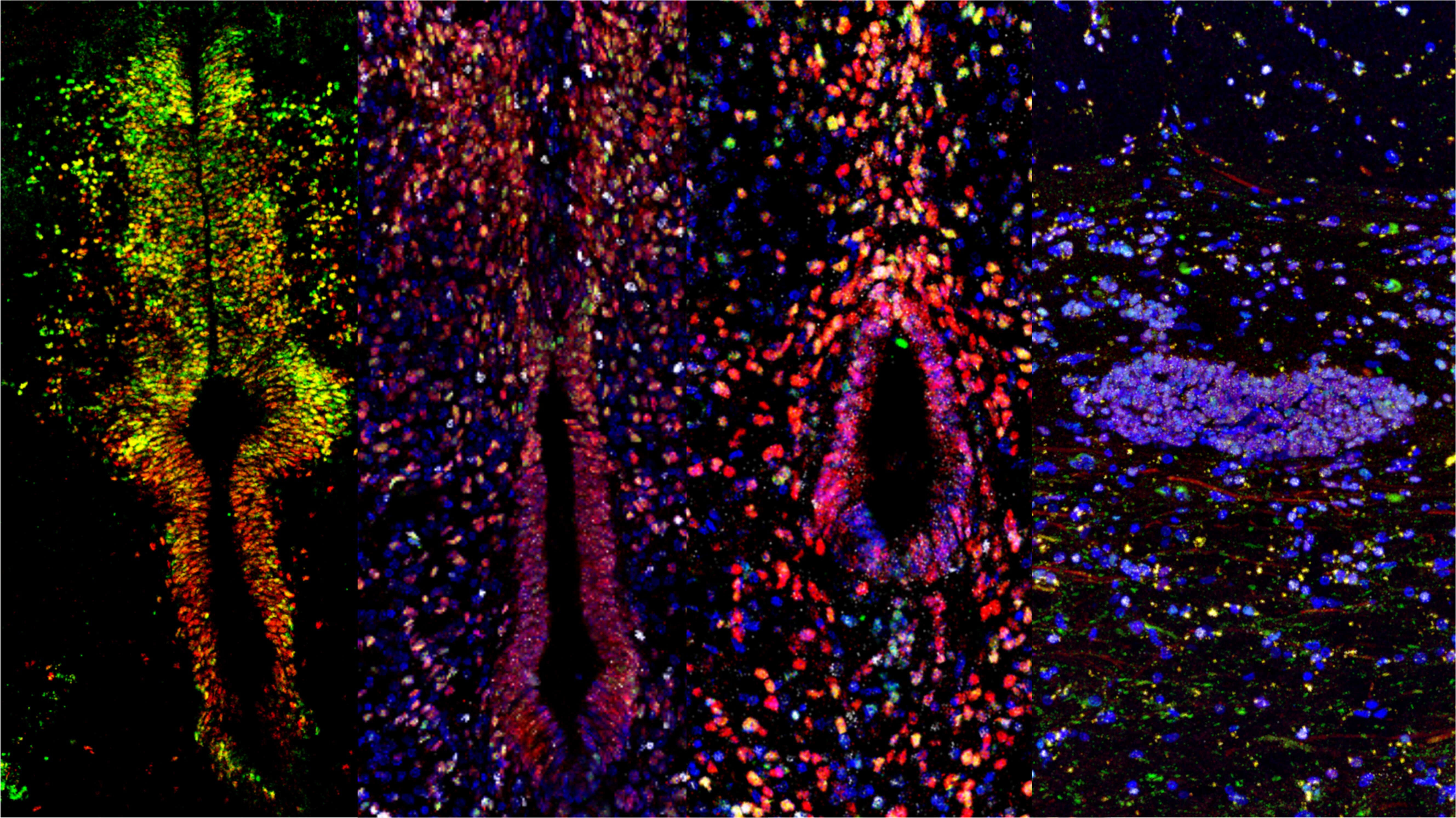 Study Unveils Differential Lineage Plasticity of Ependymal Cells and Astrocytes in Spinal Cord Injury Repair