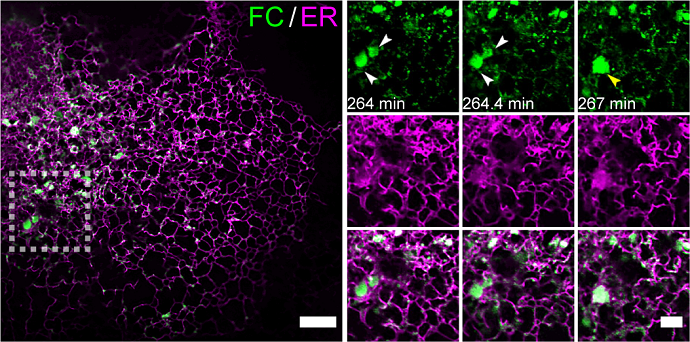 Phase Separation by Fusion Protein FC Reveals New Mechanism for Tumor Development in Rare Cancer