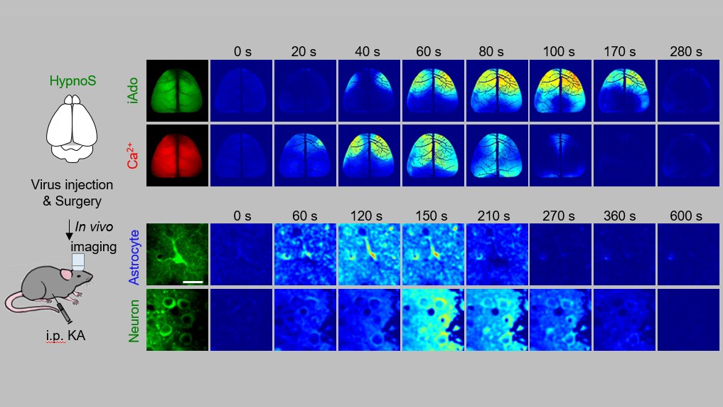 Researchers Develop High-resolution Fluorescent Sensor to Visualize Intracellular Adenosine Dynamics